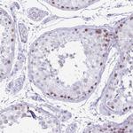 CXorf67 Antibody in Immunohistochemistry (IHC)