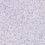 CXorf67 Antibody in Immunohistochemistry (IHC)