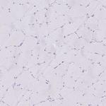 CXorf67 Antibody in Immunohistochemistry (IHC)