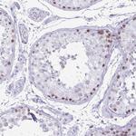 CXorf67 Antibody in Immunohistochemistry (IHC)