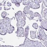 CXorf67 Antibody in Immunohistochemistry (IHC)