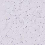 CXorf67 Antibody in Immunohistochemistry (IHC)