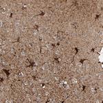 MT3 Antibody in Immunohistochemistry (Paraffin) (IHC (P))