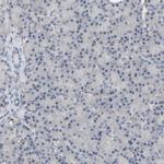 MT3 Polyclonal Antibody