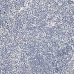 MT3 Antibody in Immunohistochemistry (Paraffin) (IHC (P))