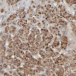 SLC30A9 Antibody in Immunohistochemistry (Paraffin) (IHC (P))
