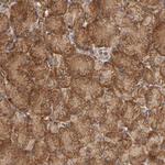 GNPTG Polyclonal Antibody