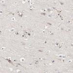 Njmu-R1 Antibody in Immunohistochemistry (Paraffin) (IHC (P))