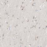Njmu-R1 Antibody in Immunohistochemistry (Paraffin) (IHC (P))