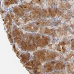 Njmu-R1 Antibody in Immunohistochemistry (Paraffin) (IHC (P))