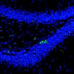 Njmu-R1 Antibody in Immunohistochemistry (Paraffin) (IHC (P))