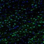 Njmu-R1 Antibody in Immunohistochemistry (Paraffin) (IHC (P))