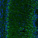 Njmu-R1 Antibody in Immunohistochemistry (Paraffin) (IHC (P))