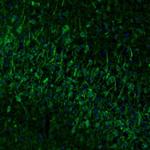Njmu-R1 Antibody in Immunohistochemistry (Paraffin) (IHC (P))