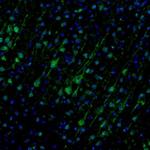 Njmu-R1 Antibody in Immunohistochemistry (Paraffin) (IHC (P))