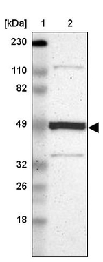 Njmu-R1 Antibody in Western Blot (WB)