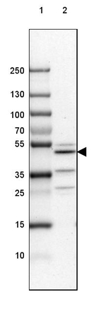 Njmu-R1 Antibody in Western Blot (WB)