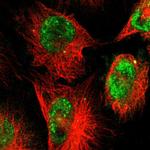 ZNF222 Polyclonal Antibody