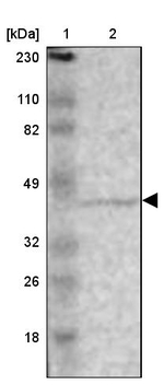 ZNF222 Antibody in Western Blot (WB)