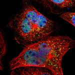 SMARCD1 Antibody in Immunocytochemistry (ICC/IF)