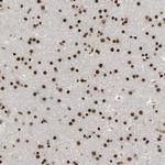 SMARCD1 Antibody in Immunohistochemistry (Paraffin) (IHC (P))