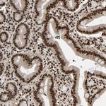 SMARCD1 Antibody in Immunohistochemistry (Paraffin) (IHC (P))