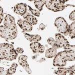 SMARCD1 Antibody in Immunohistochemistry (Paraffin) (IHC (P))