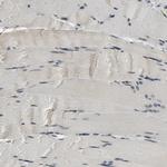 SMARCD1 Antibody in Immunohistochemistry (Paraffin) (IHC (P))