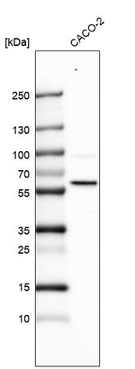 SMARCD1 Antibody in Western Blot (WB)