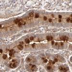 AP1G2 Antibody in Immunohistochemistry (Paraffin) (IHC (P))