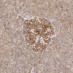 AP1G2 Antibody in Immunohistochemistry (Paraffin) (IHC (P))