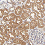 AP1G2 Antibody in Immunohistochemistry (Paraffin) (IHC (P))