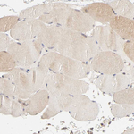 AP1G2 Polyclonal Antibody