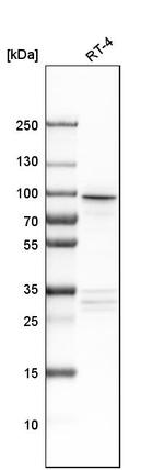 AP1G2 Antibody in Western Blot (WB)