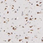 RPS29 Antibody in Immunohistochemistry (Paraffin) (IHC (P))