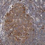 RPS29 Antibody in Immunohistochemistry (Paraffin) (IHC (P))