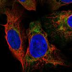 DNAAF2 Polyclonal Antibody