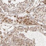 DNAAF2 Antibody in Immunohistochemistry (Paraffin) (IHC (P))