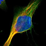 PYGL Polyclonal Antibody