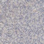 PYGL Antibody in Immunohistochemistry (Paraffin) (IHC (P))