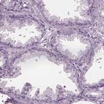 TPPP2 Antibody in Immunohistochemistry (IHC)
