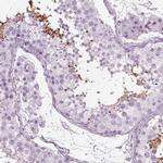 TPPP2 Antibody in Immunohistochemistry (IHC)