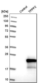 TPPP2 Antibody in Western Blot (WB)