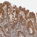 LAMTOR2 Antibody in Immunohistochemistry (Paraffin) (IHC (P))