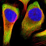 RPL14 Polyclonal Antibody