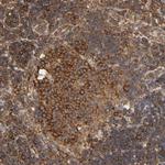 RPL14 Antibody in Immunohistochemistry (Paraffin) (IHC (P))