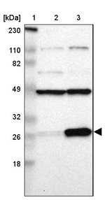 RPL14 Antibody in Western Blot (WB)