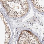 RBM23 Antibody in Immunohistochemistry (IHC)