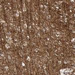 AHNAK2 Antibody in Immunohistochemistry (Paraffin) (IHC (P))