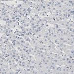 AHNAK2 Antibody in Immunohistochemistry (Paraffin) (IHC (P))